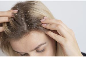 Kulit kepala antigatal, ini cara optimalkan sampo untuk menghilangkan ketombe membandel pakai 1 buah