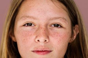 Cara memudarkan flek hitam di wajah pakai krim dari 1 bumbu dapur ini bikin kulit auto glow up