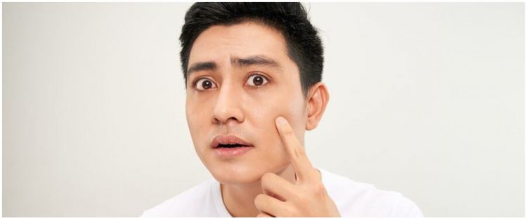 Perjalanan Kulit Dari Kusam Ke Glowing Dalam 6 Bulan