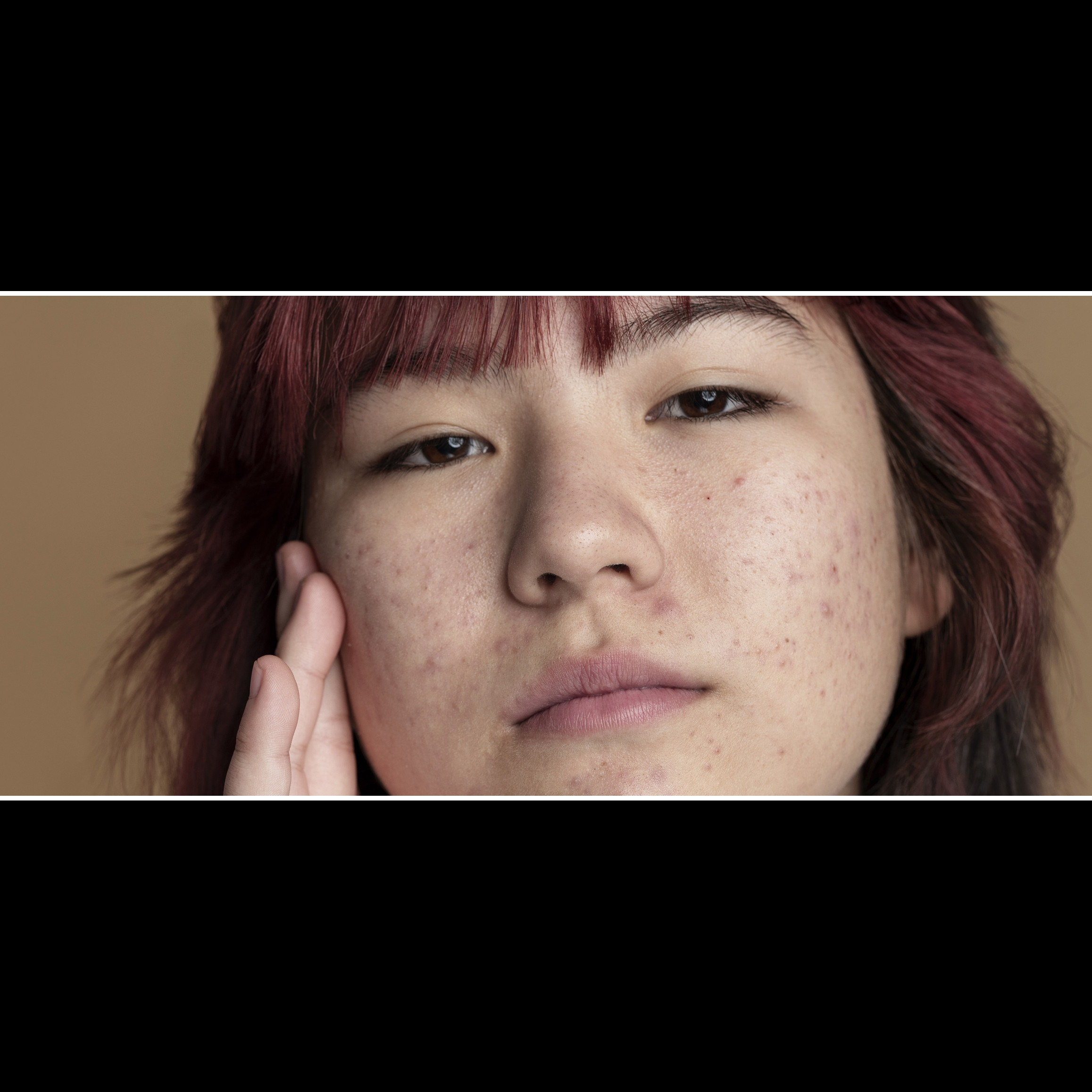 Tanpa scrub gula, ini cara bersihkan pori-pori tersumbat agar hidung mulus bebas komedo pakai 1 buah