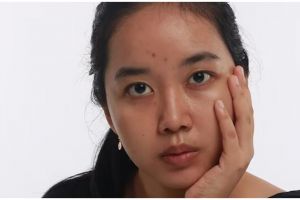 Hilangkan bintik hitam di wajah pakai masker dari 1 bahan masakan, bikin kulit auto glowing