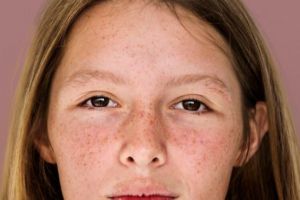 Wajah mulus tanpa laser mahal, ini trik pudarkan flek hitam cuma pakai 1 jenis tanaman herbal