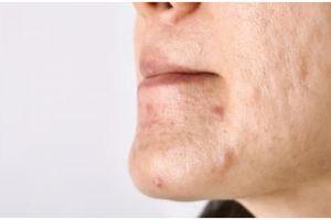 Tak perlu beli produknya, ini cara hempaskan radikal bebas di pori-pori pakai face wash dari 1 daun