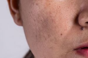 Kulit kencang tanpa krim antiaging, ini cara atasi flek hitam dan wajah kendur pakai 1 jenis minyak