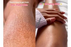 Tanpa beli lotion, ini cara haluskan kulit badan kering bersisik pakai body gel dari 1 bahan pemanis