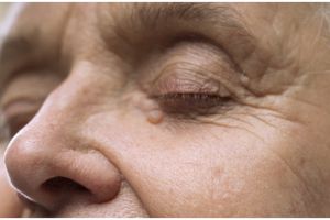 Usia 60 terlihat 15 tahun lebih muda, ini cara kembalikan wajah keriput jadi halus pakai 1 jenis buah