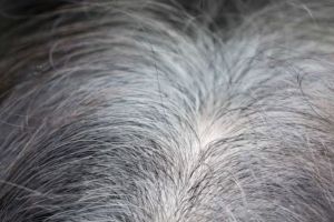 Tanpa kopi dan jintan, begini trik mencegah uban tumbuh semakin banyak pakai 1 jenis buah