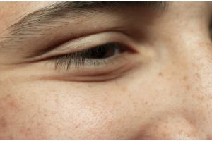 Tanpa treatment laser, ini cara pudarkan pigmentasi akibat penuaan pakai masker dari 1 bahan salad