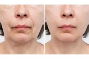 Tanpa putih telur, ini cara bikin kencang wajah kendur agar kembali muda pakai 1 jenis daun penyedap