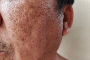 Bukan cuma kunyit, ini trik haluskan wajah kasar berpori-pori besar pakai 1 sumber protein