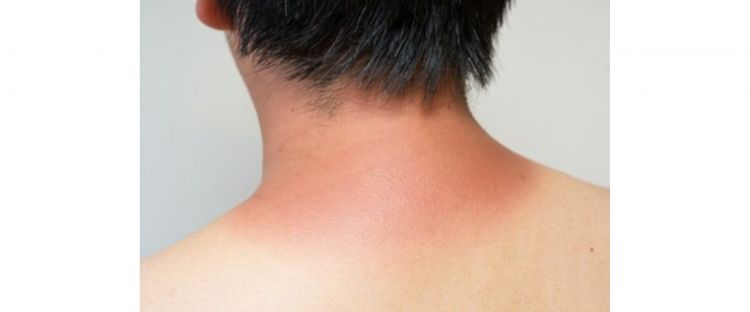 Elak Guna Produk Putihkan Kulit Yang Tidak Diluluskan KKM
