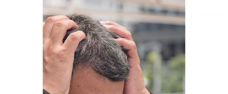 Tanpa spray pewarna rambut, ini cara bikin uban pudar dan kembali hitam pakai 1 jenis daun