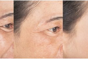 Kulit sehat bak remaja di usia kepala 4, ini trik kurangi wajah kendur berkerut pakai 1 jenis minuman