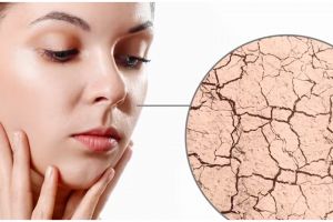 11 Rekomendasi skincare Korea untuk atasi kulit kering mulai dari Rp 30 ribu, bikin wajah auto lembap
