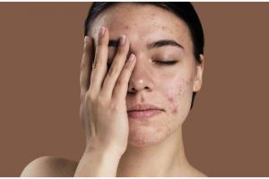 Tanpa susu, ini trik bersihkan pori-pori wajah agar tak berjerawat pakai face wash dari 1 jenis daun