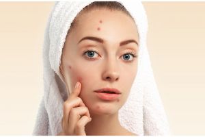 11 Rekomendasi skincare untuk kulit berminyak merek lokal di bawah Rp 250 ribu, bikin wajah antikilap