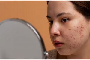 Tak ditambah kunyit, ini cara kembalikan wajah cerah akibat flek hitam hanya pakai 1 jenis tepung