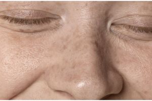 Usia 60 tampak 10 tahun lebih muda, ini cara pudarkan flek hitam pakai krim dari 1 jenis buah