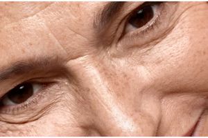 Tanpa gunakan masker, ini trik hilangkan flek hitam akibat penuaan pakai krim dari 1 bunga