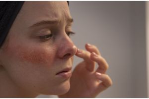 Tanpa gunakan petroleum jelly, cara agar kulit wajah bebas kering dan kasar pakai 1 bahan minuman