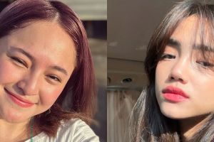 8 Seleb ini ngaku alami gangguan mental, Fuji anggap kondisinya bukan aib tapi berkah