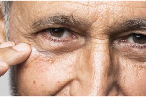 Hasilnya terlihat dalam 7 hari, ini cara membuat minuman kolagen untuk atasi keriput pakai 1 buah