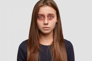 Bukan pakai ampas kopi, ini cara pudarkan kerutan dan mata panda cuma dengan 1 bahan lalapan