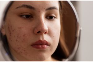 Tak pakai masker air beras, ini cara cerahkan pigmentasi agar wajah glowing pakai masker dari 1 umbi