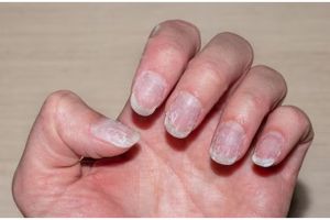 Tanpa perlu perawatan di salon, ini cara mengatasi kuku kasar agar auto halus pakai 1 jenis buah