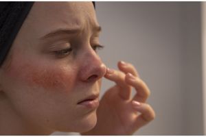 Tanpa petroleum jelly, ini cara menghidrasi kulit kering bikin auto lembap pakai toner dari 1 sayur