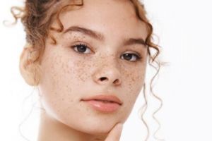 Tanpa pakai kunyit, ini cara pudarkan flek hitam di wajah agar cerah merata dengan 1 jenis buah