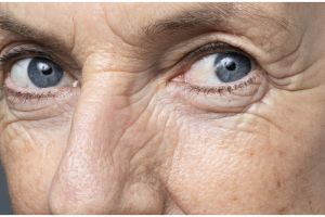 Tanpa treatment laser, ini cara haluskan wajah keriput dan berflek hitam pakai serum dari 1 jenis buah