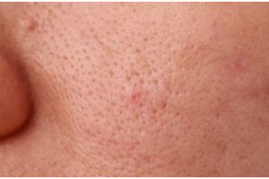 Tak dicampur lemon, cara bersihkan pori-pori dari kotoran pakai night cream berbahan 1 jenis kacang