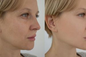 Tanpa madu, ini cara agar wajah kering berkeriput jadi kenyal pakai krim kolagen dari 1 jenis minyak