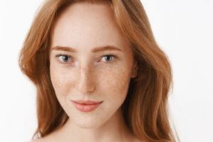 Nggak cuma pakai susu, ini cara atasi flek hiperpigmentasi wajah pakai tambahan 1 bahan minuman