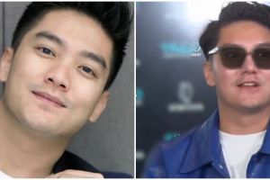 Diam-diam Boy William ubah bentuk hidung, begini potretnya sebelum dan sesudah operasi plastik