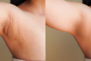 Bukan pakai deodoran, ini trik memutihkan ketiak hitam berbau pakai 1 jenis buah