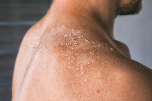 Tak hanya aloe vera, ini trik bikin kulit kering bersisik jadi lembap seharian pakai 2 jenis minyak