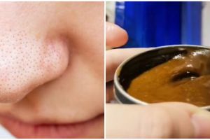 Tanpa baking soda, ini trik atasi pori-pori besar akibat komedo di wajah pakai 1 jenis rempah