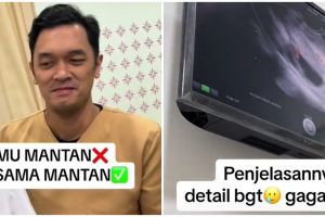 Wanita ngaku di-USG ‘mantan’ ini bikin yang lihat senyum sendiri, pas tahu maksudnya auto tepuk jidat