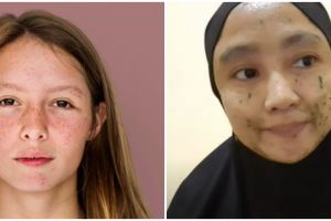 Trik pudarkan bintik hitam pada wajah cuma pakai masker dari 1 jenis daun, bikin kulit auto glowing