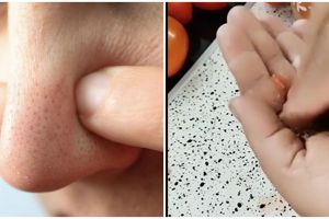 Tanpa produk scrub, ini cara atasi wajah berkomedo agar pori-pori bersih pakai masker 1 bahan dapur