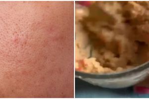 Tanpa dicampur lemon, ini cara mengecilkan pori-pori wajah agar kulit halus pakai 1 jenis buah