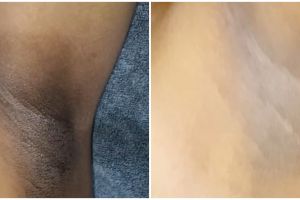 Kulit kembali jadi glowing, ini trik mencerahkan ketiak yang hitam pekat pakai 1 bumbu dapur