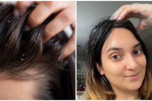 Tanpa sampo khusus, ini cara atasi ketombe dan kulit kepala mengelupas cuma pakai 2 bahan dapur