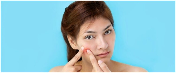 11 Rekomendasi skincare moisturizer untuk kulit sensitif merek lokal