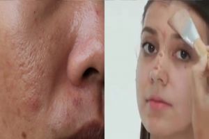 Tanpa tepung beras, ini trik atasi pori-pori besar di wajah kusam dan berminyak pakai 2 jenis buah