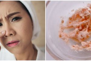 Wajah glowing dan bebas komedo, ini cara atasi pori-pori tersumbat pakai masker dari 1 jenis tepung
