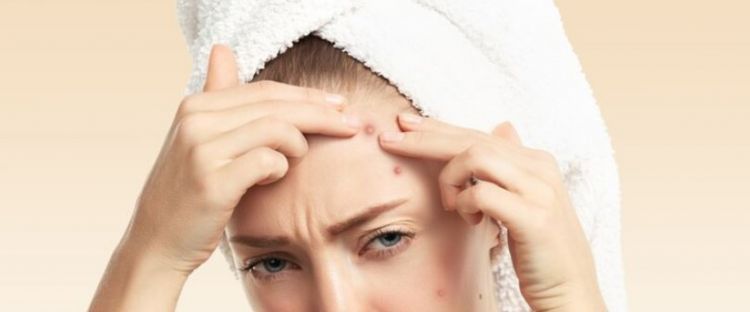 11 Produk skincare untuk jerawat batu merek lokal di bawah Rp 150 ribu, cepat kering dan antikemerahan