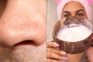 Bukan pakai ampas kopi, ini trik kurangi komedo dan minyak berlebih di kulit pakai 1 bahan dapur